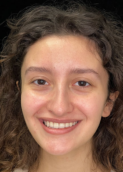 Invisalign