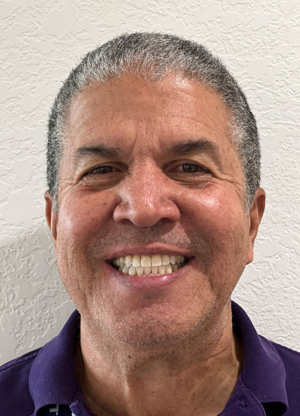 Invisalign + Teeth Whitening