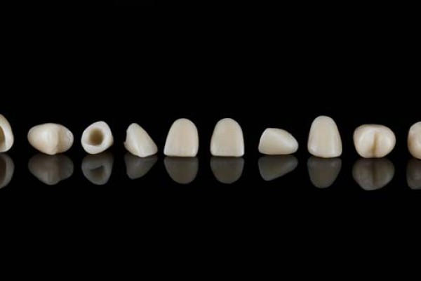 The Benefits Of CEREC Crowns: Same Day Restorations For Your Smile