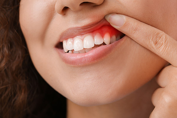 Can Gum Disease Treatment Restore My Oral Health?